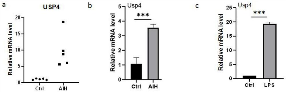 Application of USP4 as autoimmune liver disease biomarker