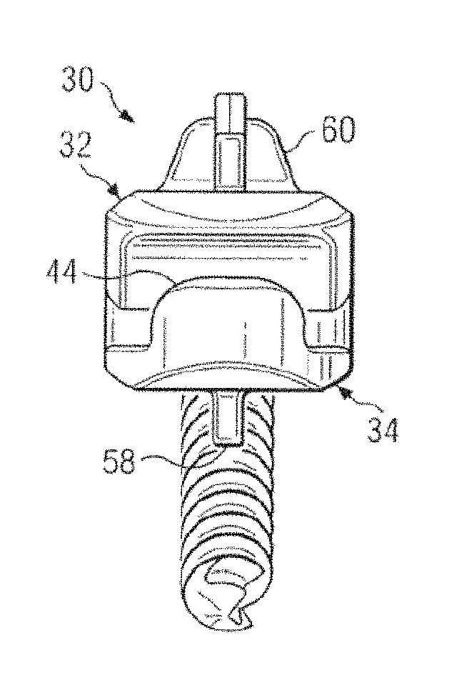 Spinal osteotomy