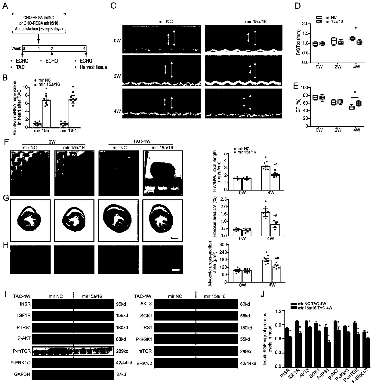 Application of miRNA in treating cardiac hypertrophy