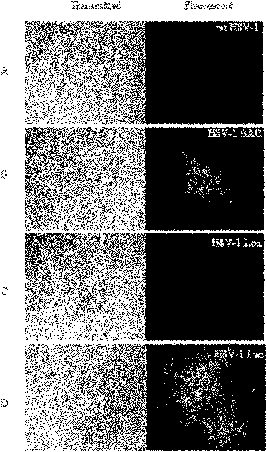 Method for constructing HSV-1 BAC system carrying luciferase report genes