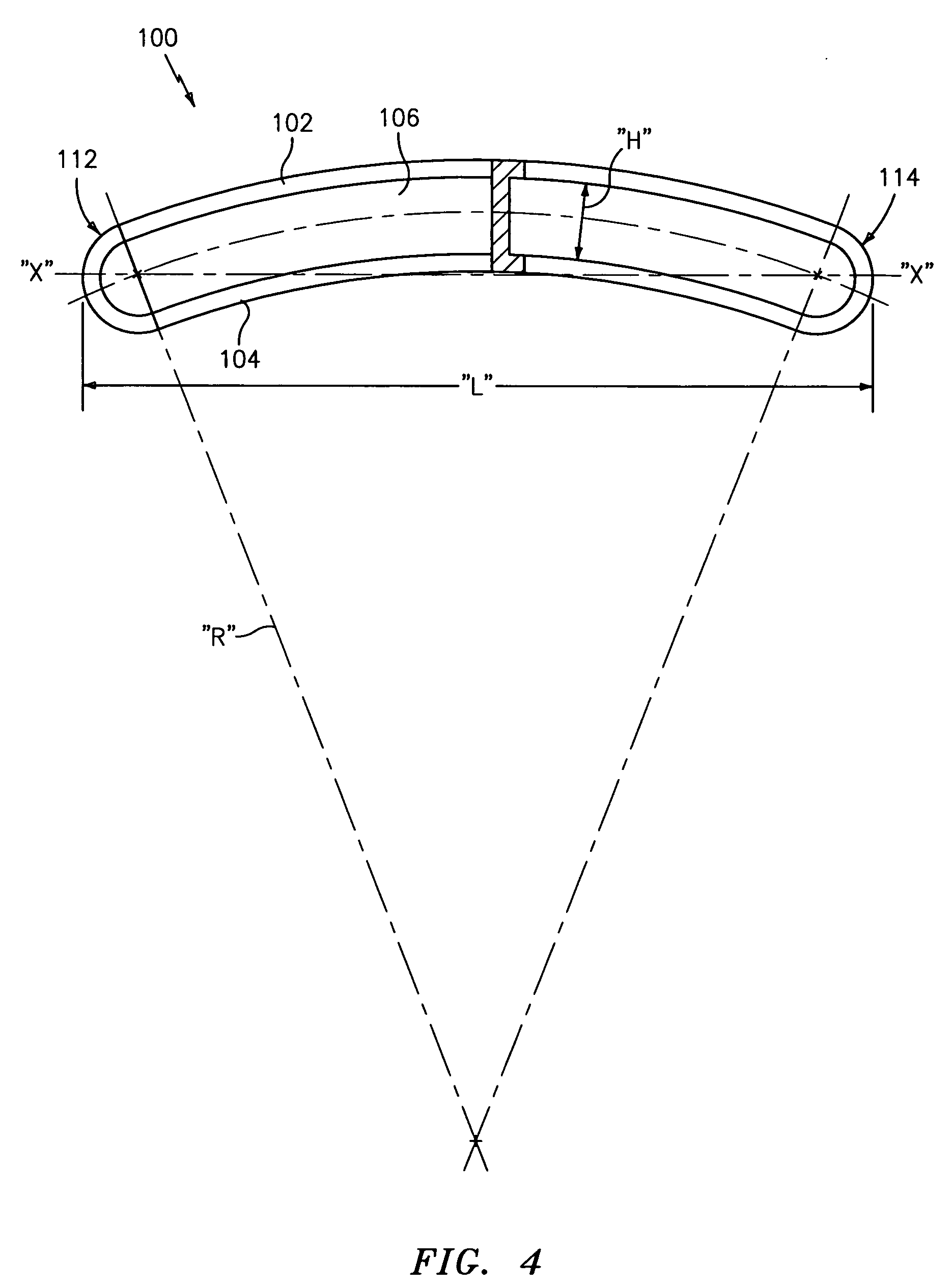 Methods and devices for minimizing the loss of blood through a severed sternum during cardiac and/or thoracic surgery