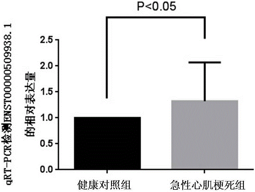 ENST00000509938.1 and preparation or diagnostic agent or drug or kit and application thereof