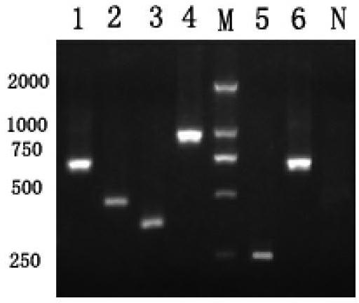 Multiplex PCR method for rapid detection and identification of five Listeria species