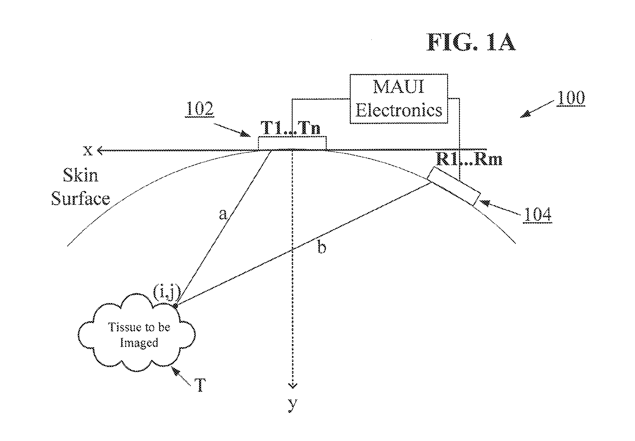 Point source transmission and speed-of-sound correction using multi-aperture ultrasound imaging