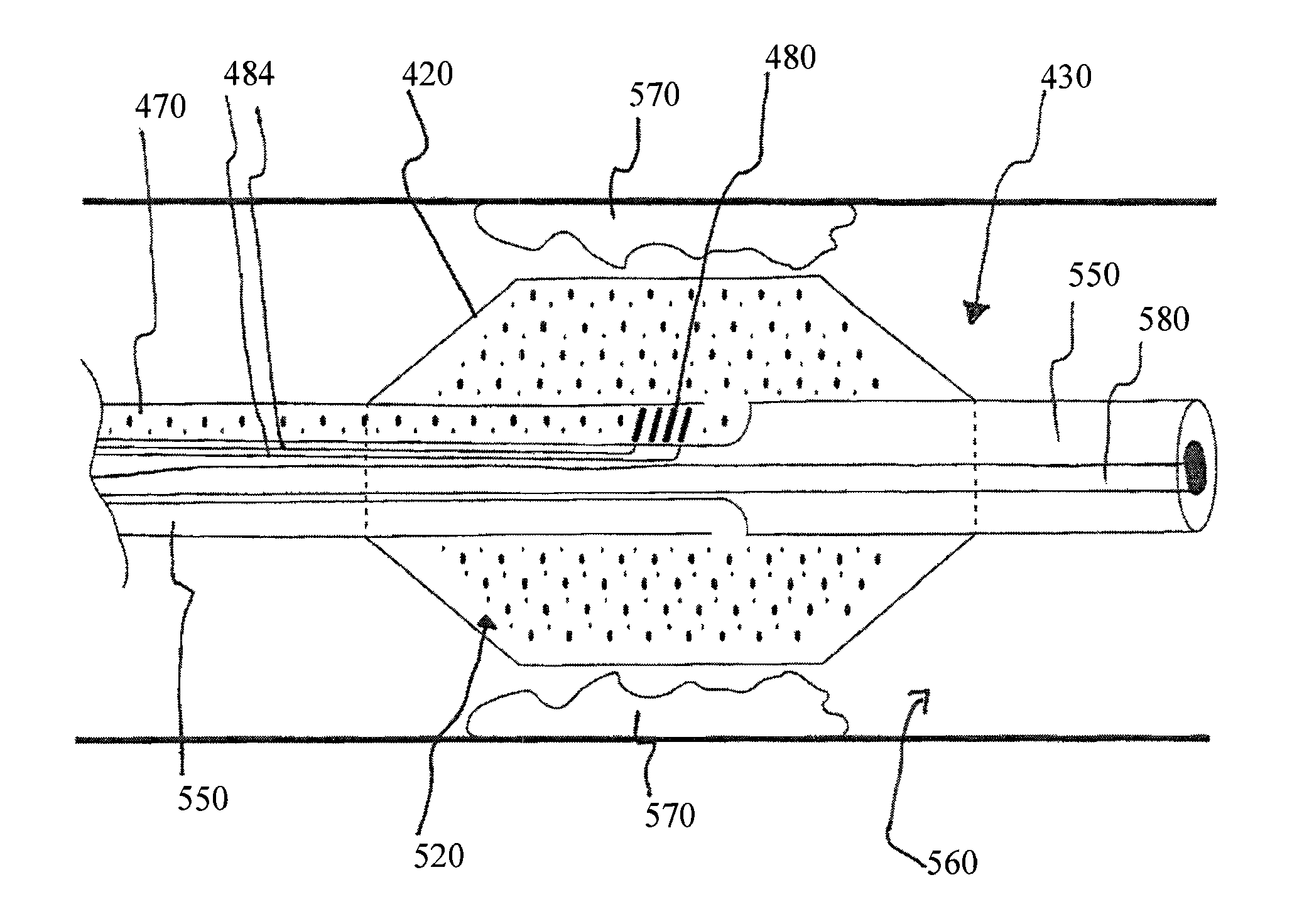 Heated balloon catheter