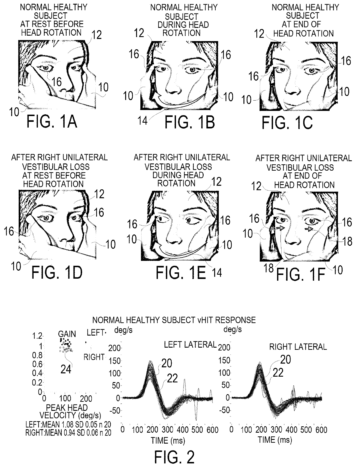 Apparatus and method for computerized rotational head impulse test