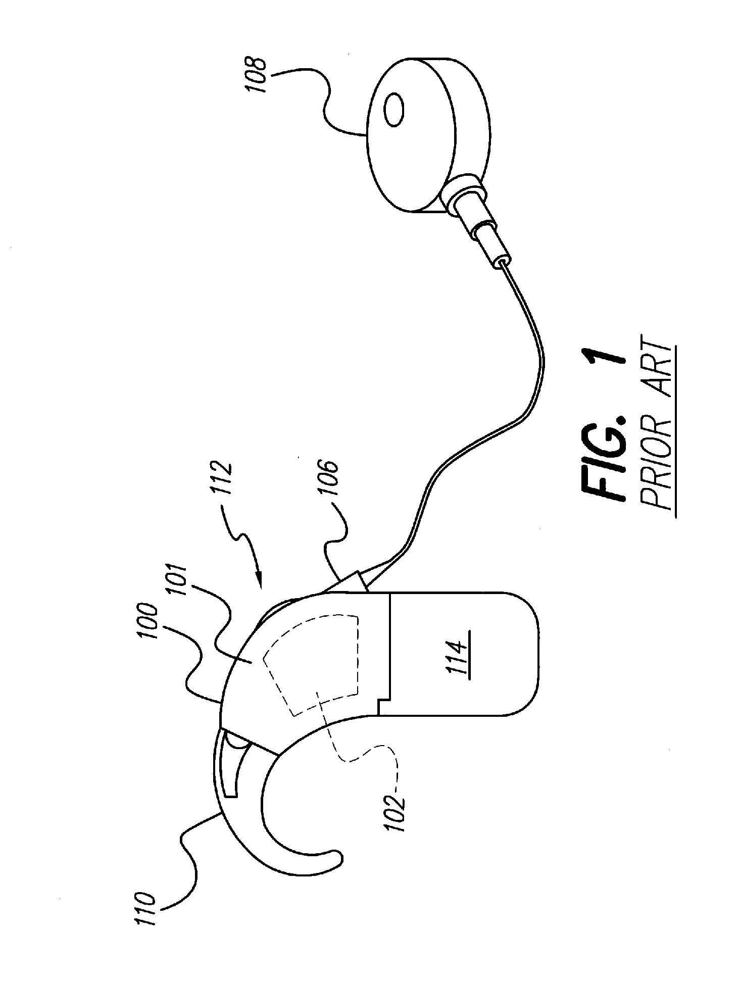 Speech processor cases