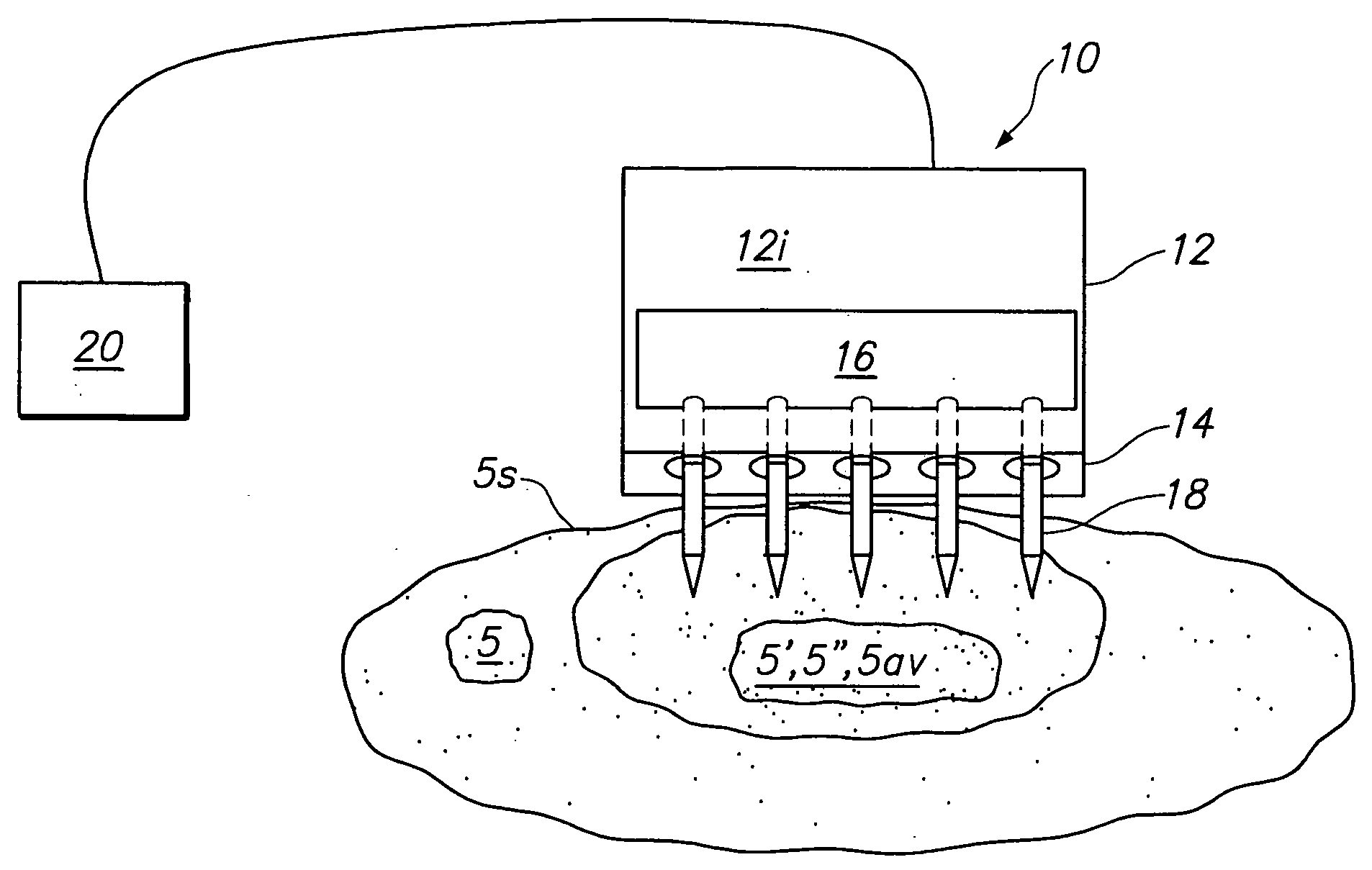 Tissue surface treatment apparatus and method