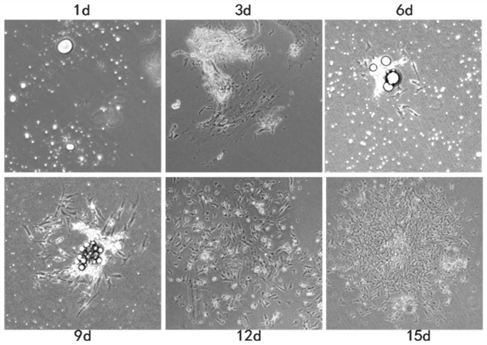 Isolation and purification of high-purity chicken precursor intramuscular adipocytes and method for constructing a co-culture system with muscle satellite cells