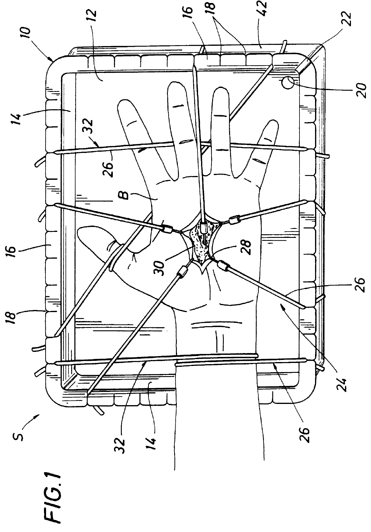 Surgical restraint system