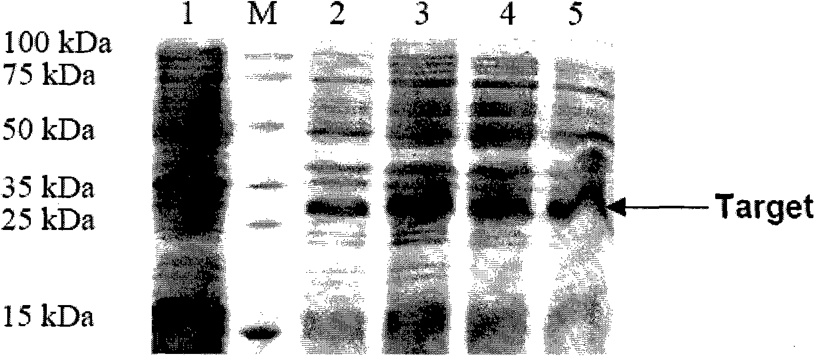 Recombinant spider poison protein, preparation method and expression vector thereof and medicament for treating (erection disturbance) ED