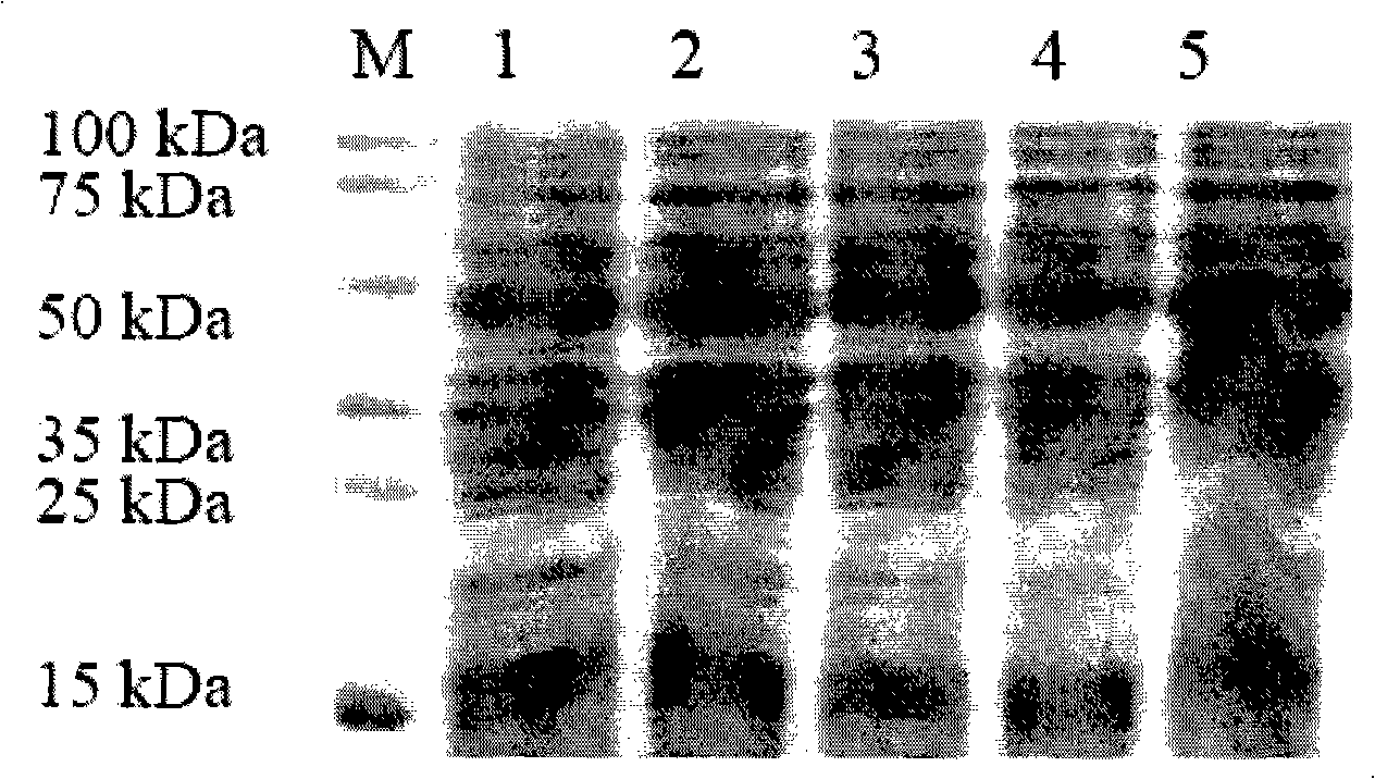 Recombinant spider poison protein, preparation method and expression vector thereof and medicament for treating (erection disturbance) ED