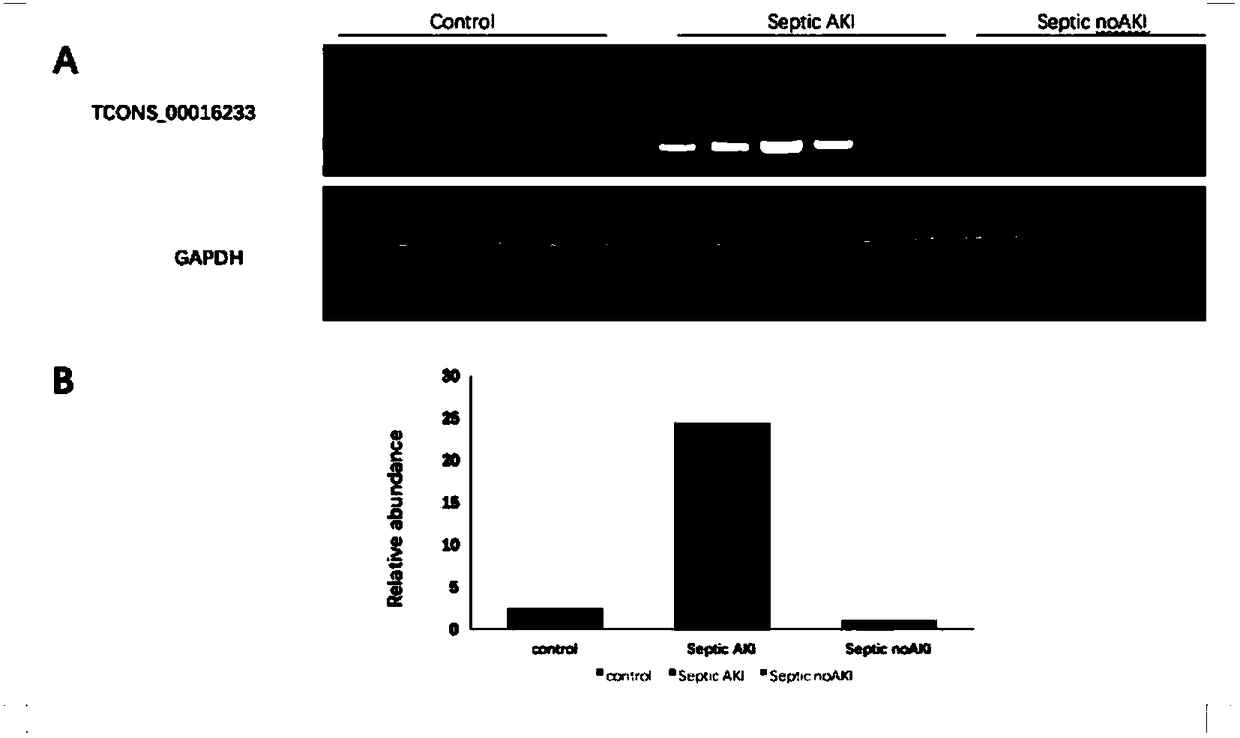 Molecular marker tcons_00016233, kit and application