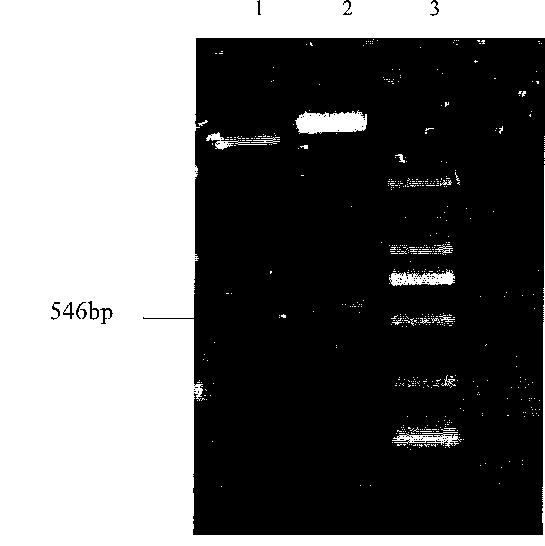 Method for producing secretion expression recombinant human fibroblast growth factor-21