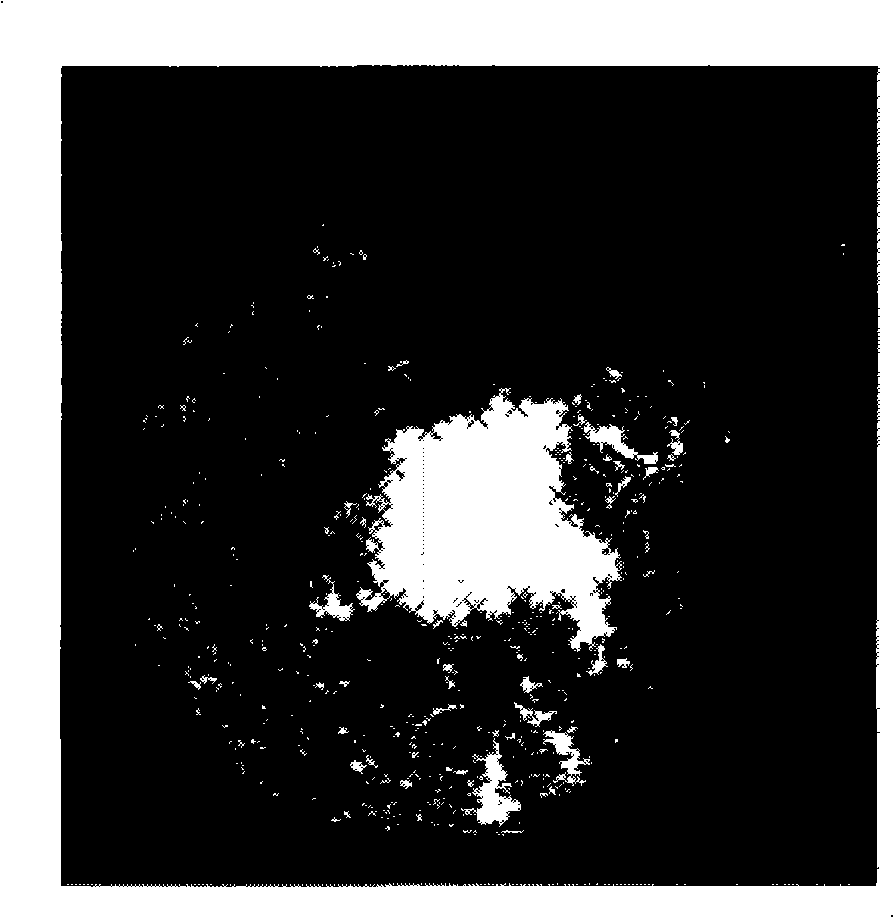 Method for measuring area and shape of forest gap