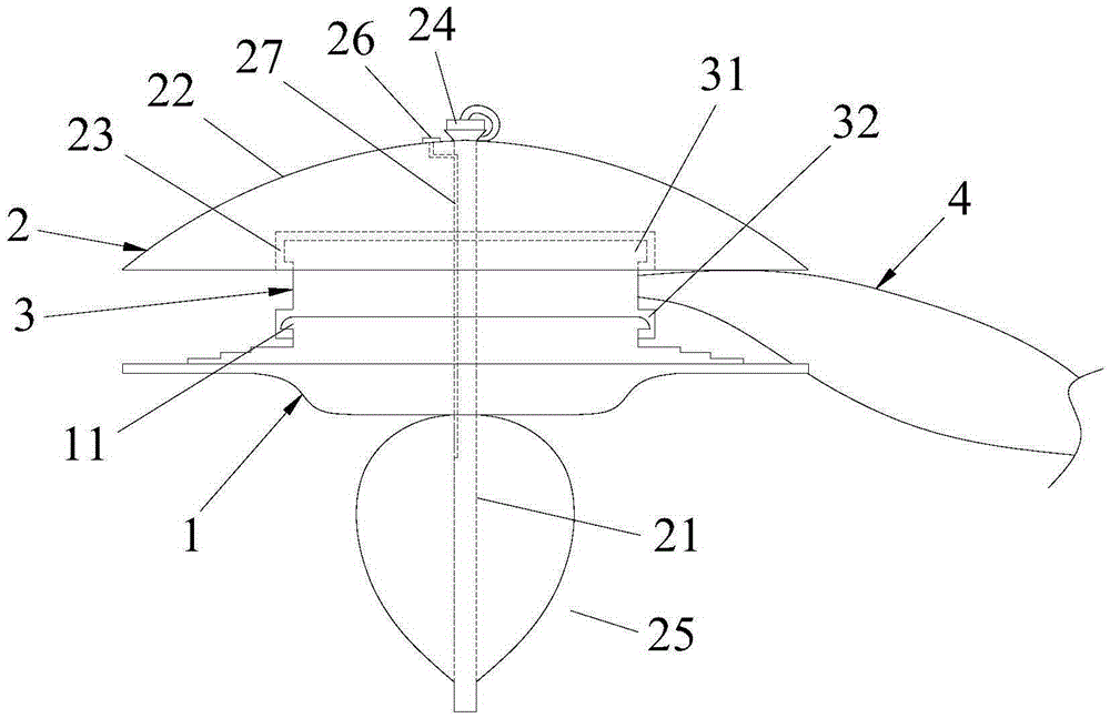 Colostomy lavage improvement device