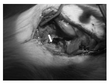 Application of rat model with depression related to chronic pain in researching on action mechanism and targets of antidepressant on pain