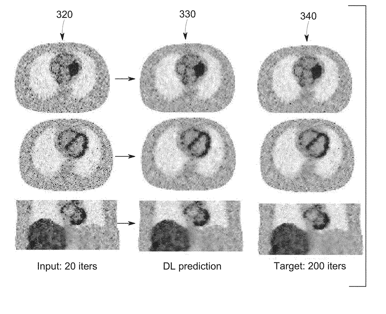 Deep learning based acceleration for iterative tomographic reconstruction