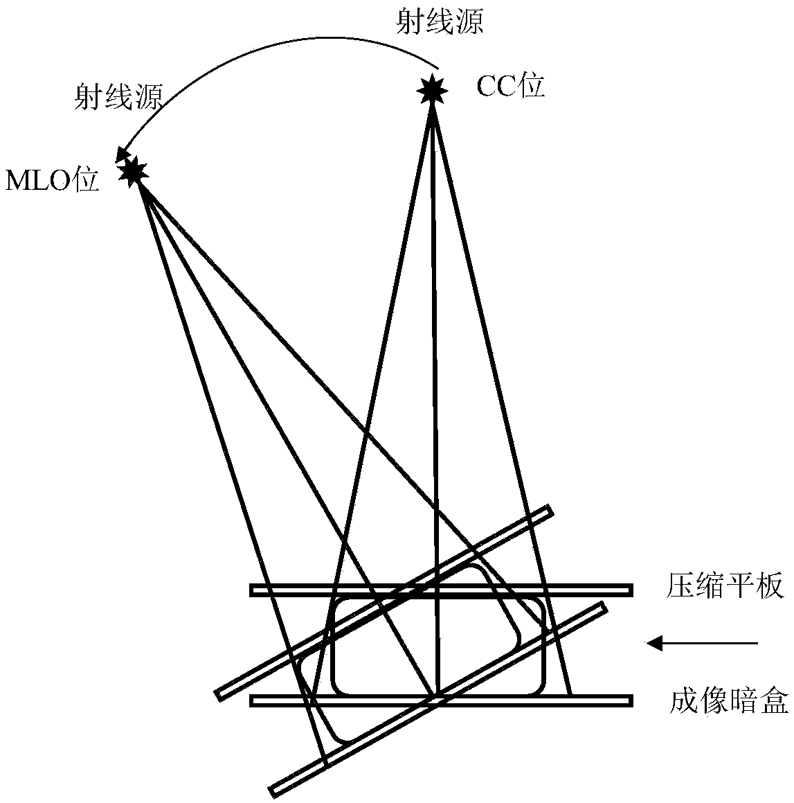 Point position association method of ipsilateral aberrant breast molybdenum target images