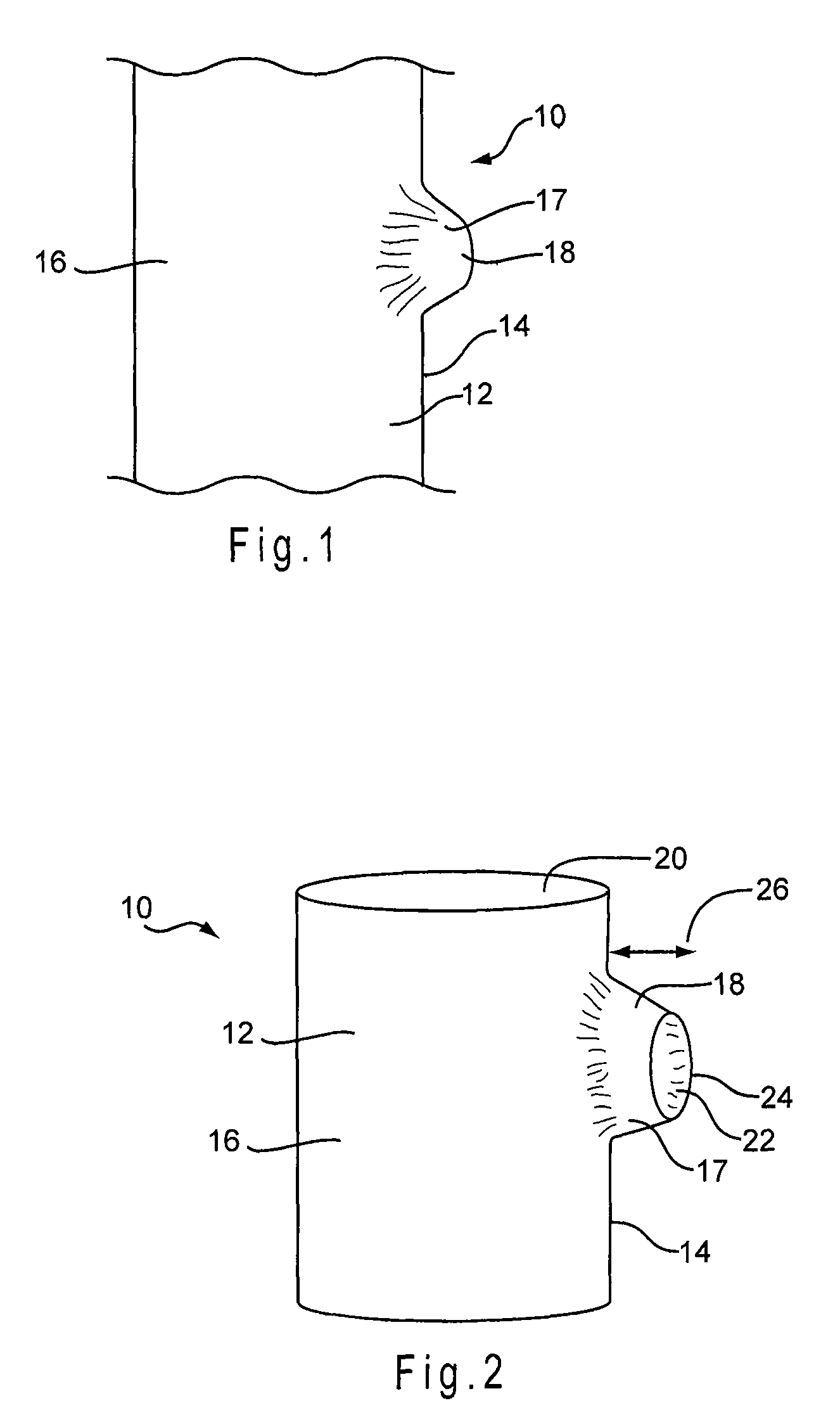 Prosthesis with moveable fenestration