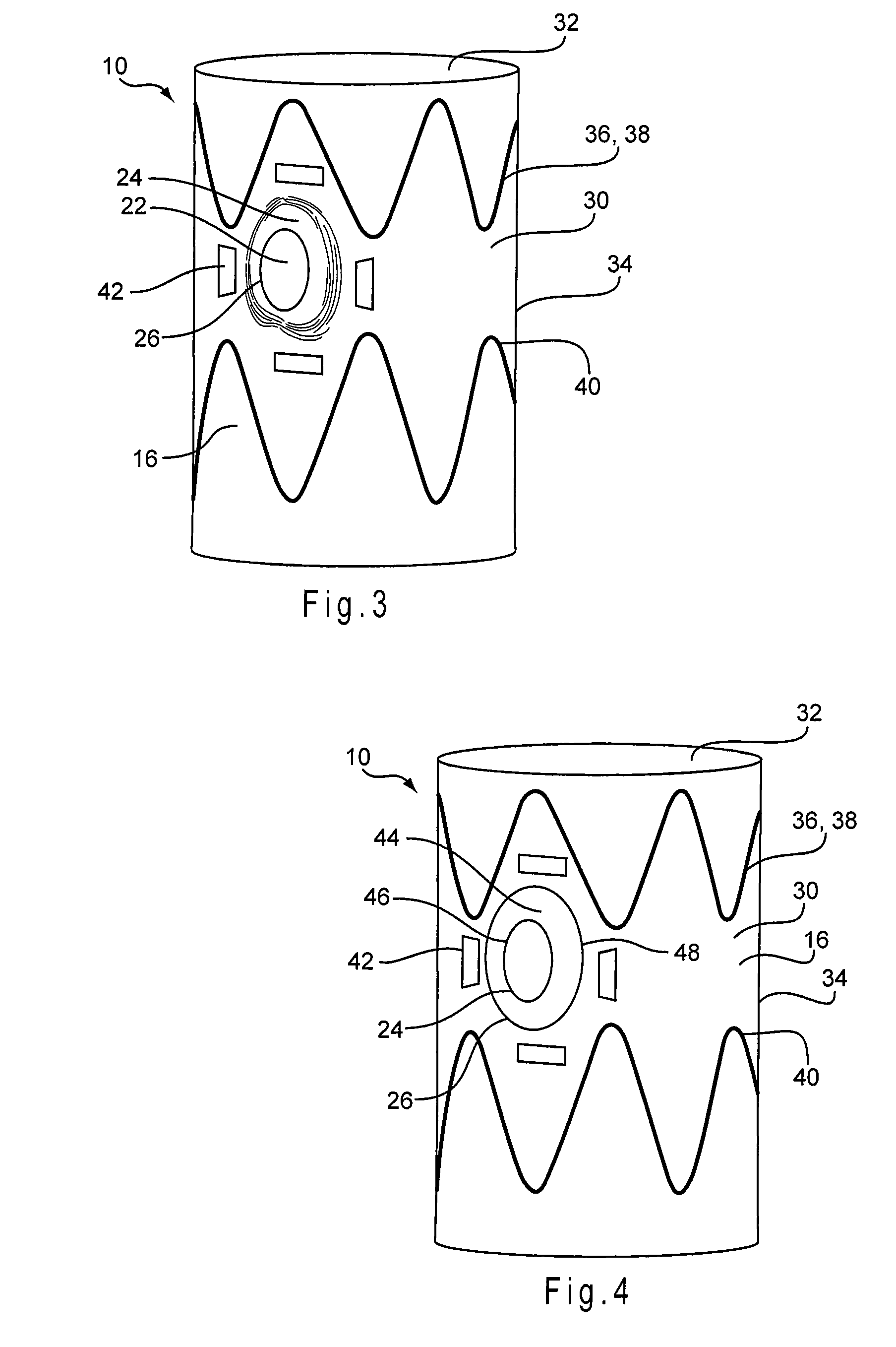 Prosthesis with moveable fenestration