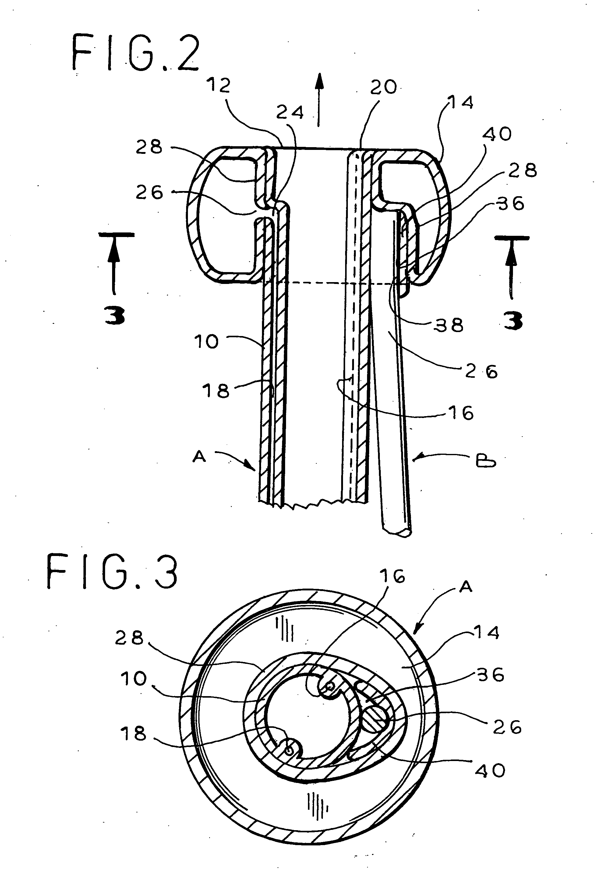 Balloon catheter with positioning pocket