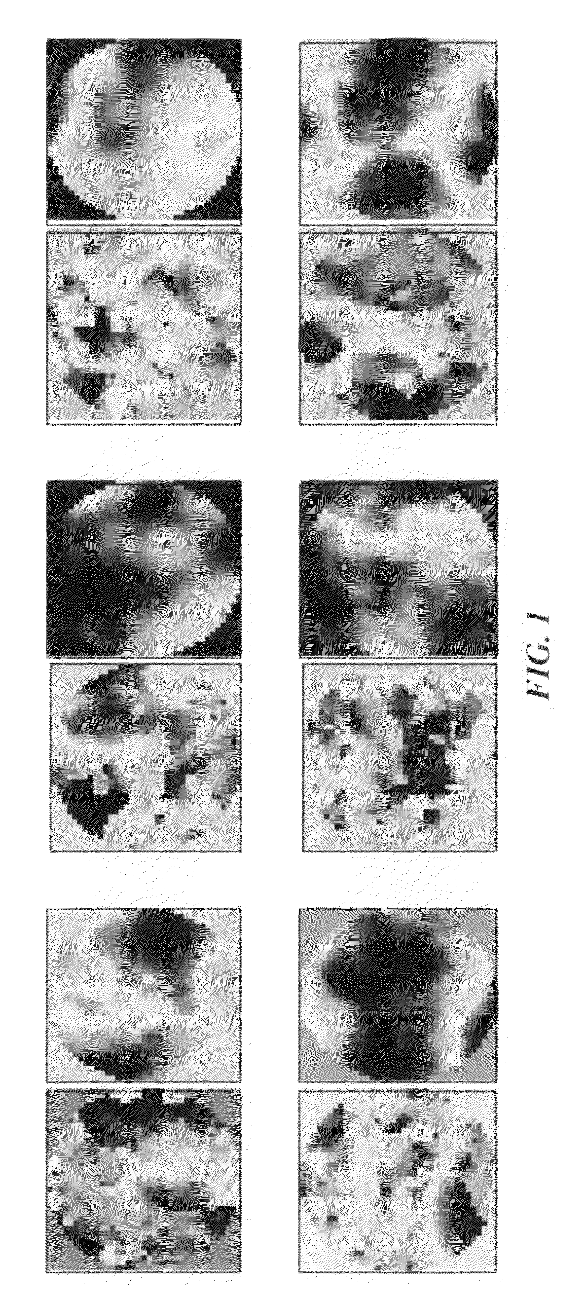 Beaconless adaptive optics system