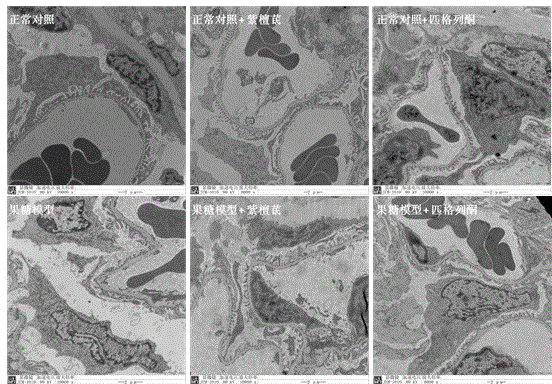 Applications of pterostilbene in preparation of medicines for preventing and treating chronic glomerular disease