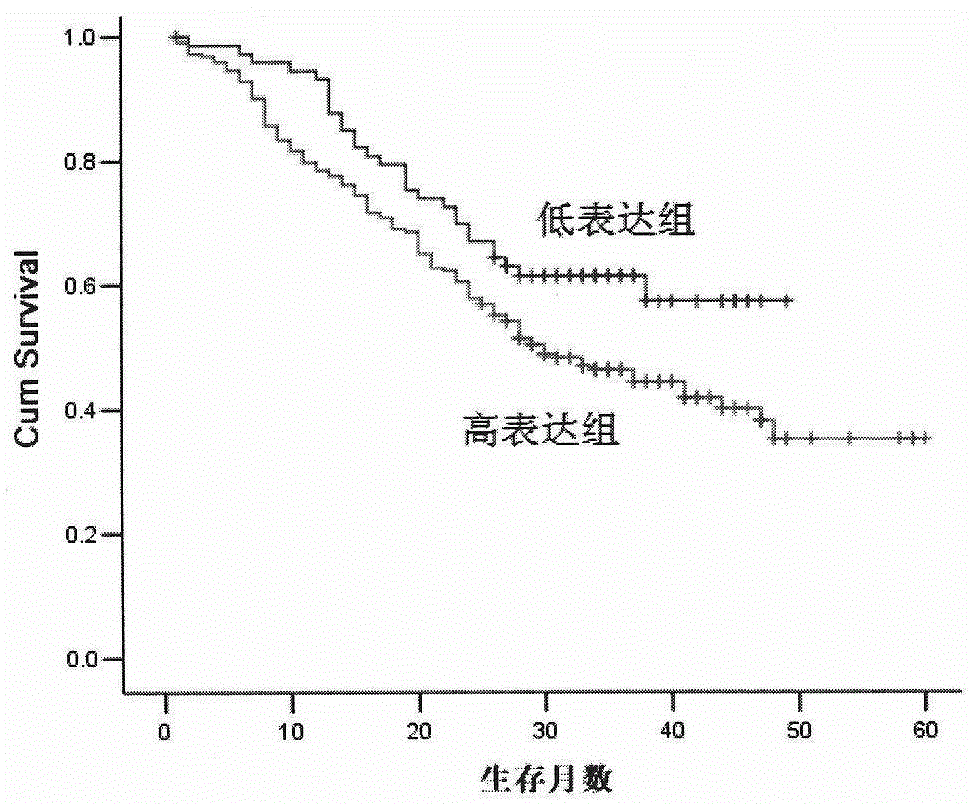 Kit for predicting prognosis of esophagus cancer patient by combining 5-lipoxygenase pathway proteins