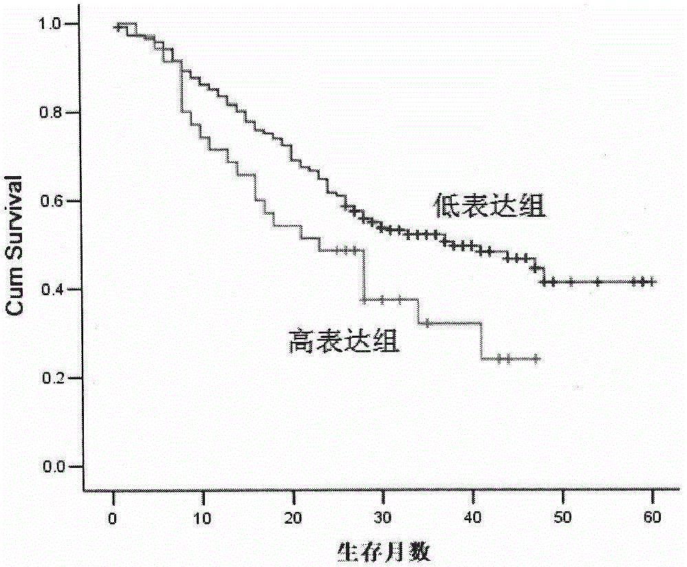 Kit for predicting prognosis of esophagus cancer patient by combining 5-lipoxygenase pathway proteins