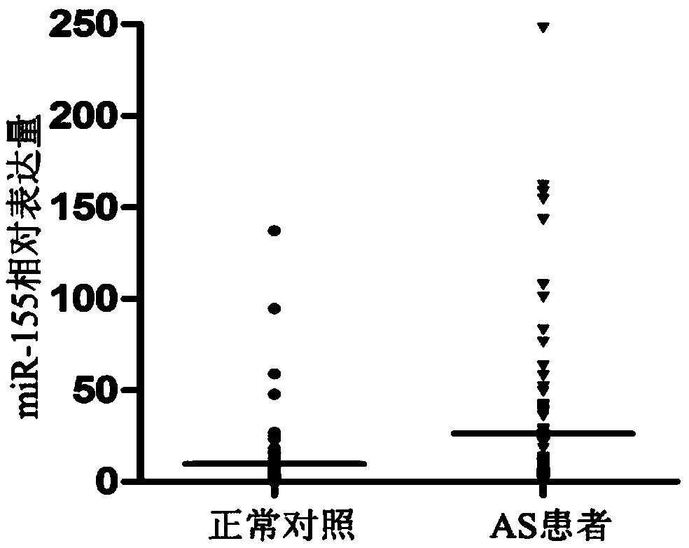 MiRNA detection kit and application thereof in diagnosis of degree of coronary stenosis