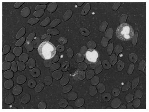 Full-automatic high-performance leukocyte segmentation method