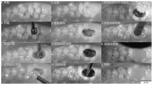 Application of miR-93 inhibitor in preparing medicaments for repairing dentin