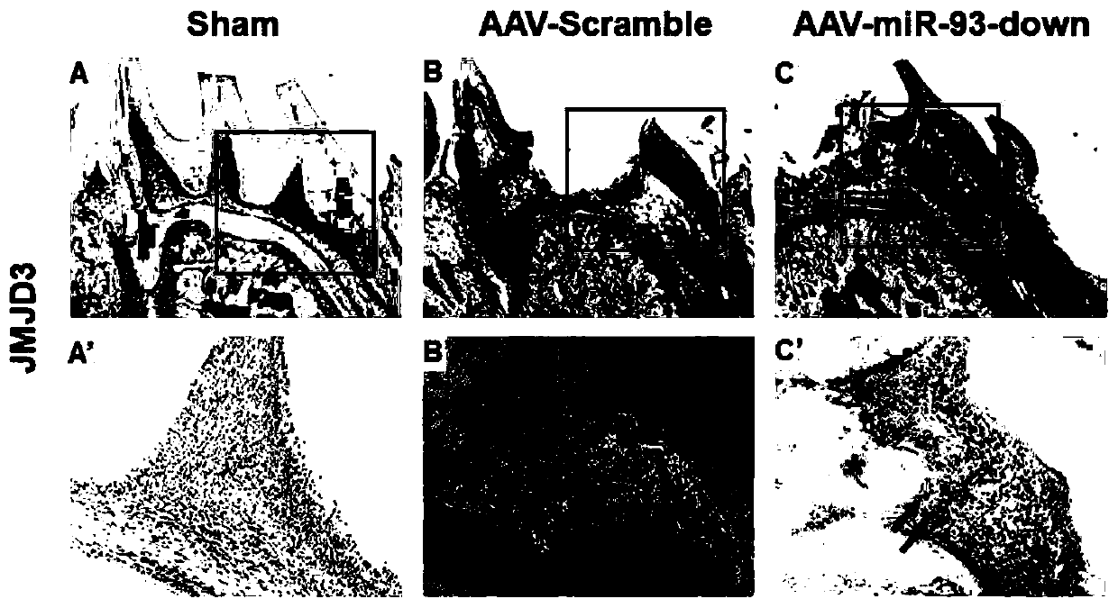 Application of miR-93 inhibitor in preparing medicaments for repairing dentin