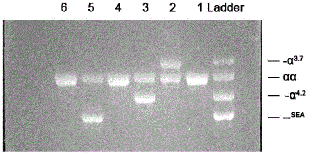 Thalassemia gene detection method based on fluorescence labeling quantitation PCR (Polymerase Chain Reaction) technology