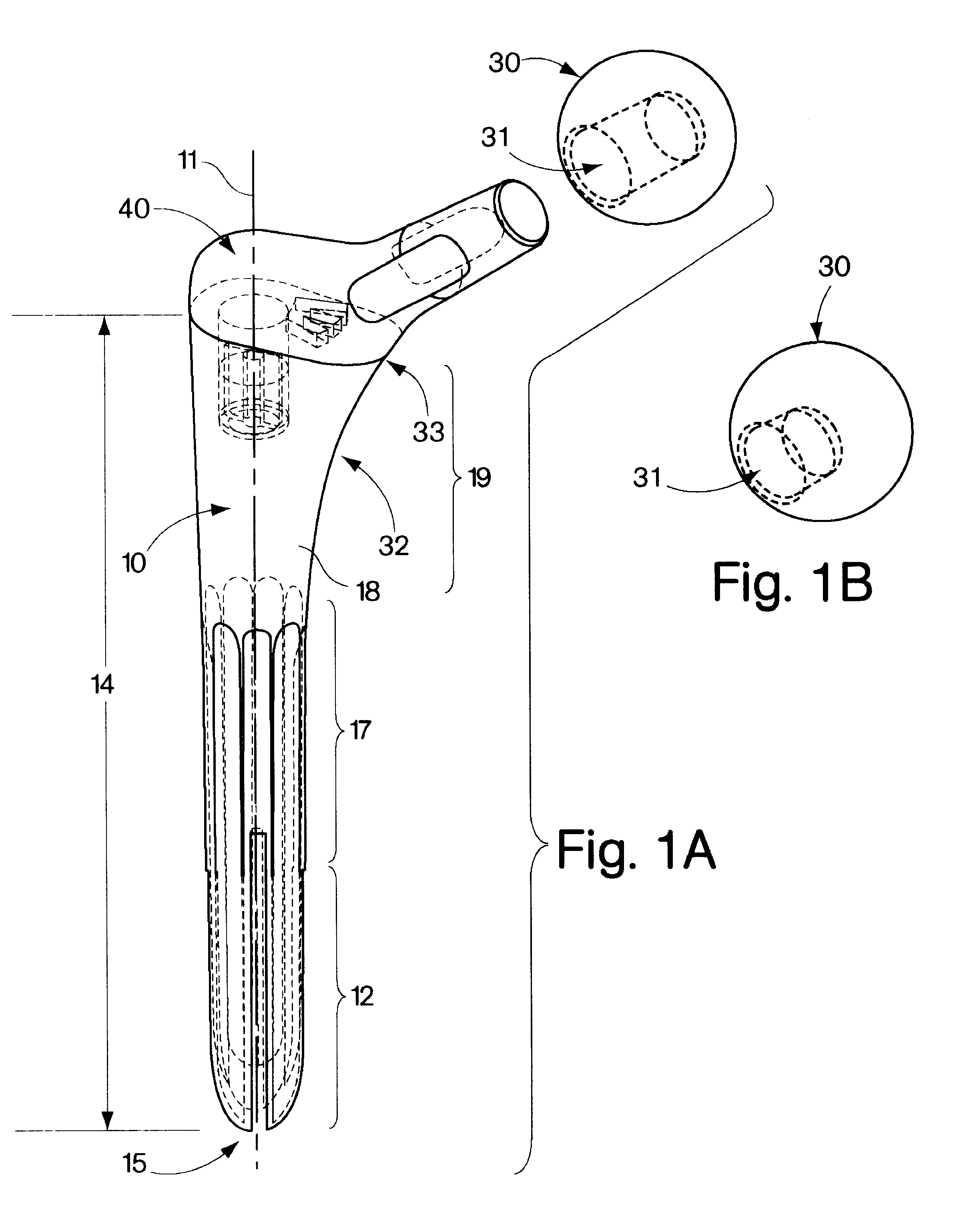 Joint prostheses and components thereof