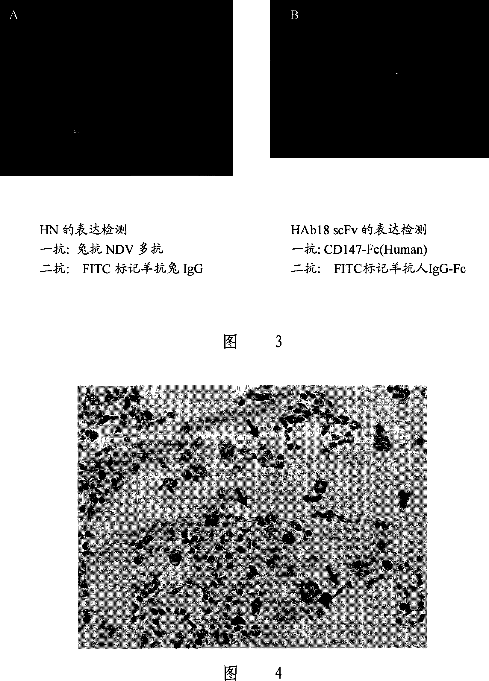 Tumor targeting recombinant newcastle disease viruses and construction method thereof