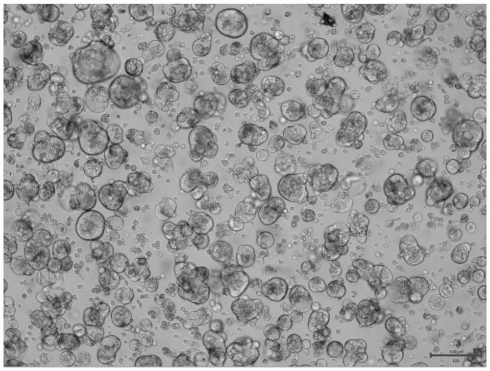 Method for culturing gastric cancer solid tumor primary cells