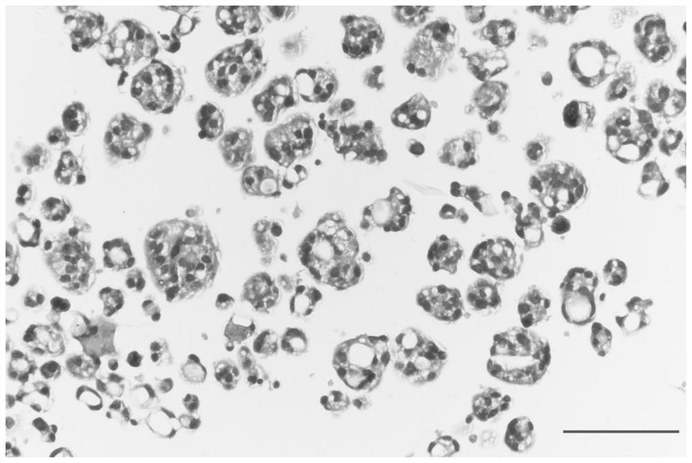 Method for culturing gastric cancer solid tumor primary cells