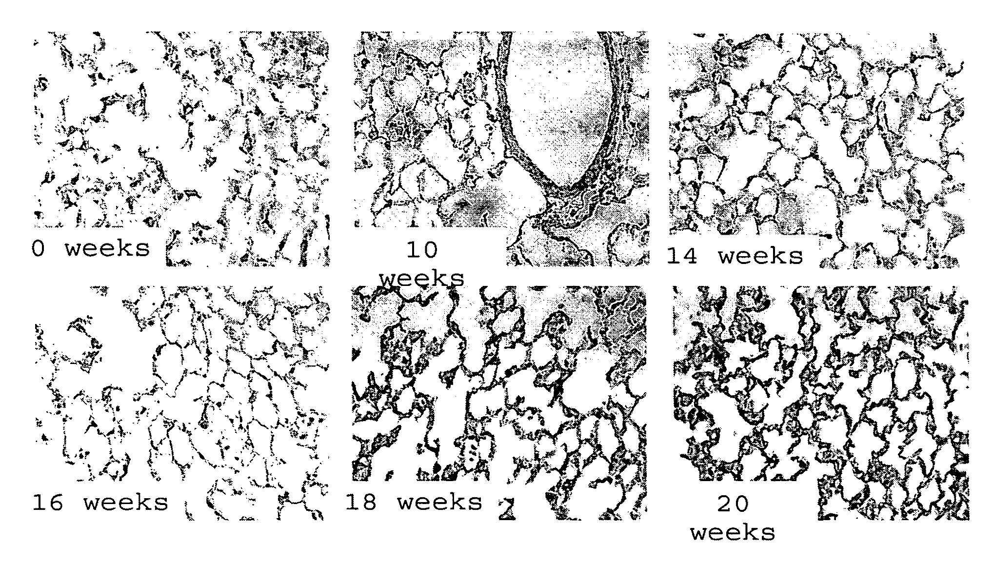 Anti-Alpha v Beta 6 Antibodies and Uses Thereof