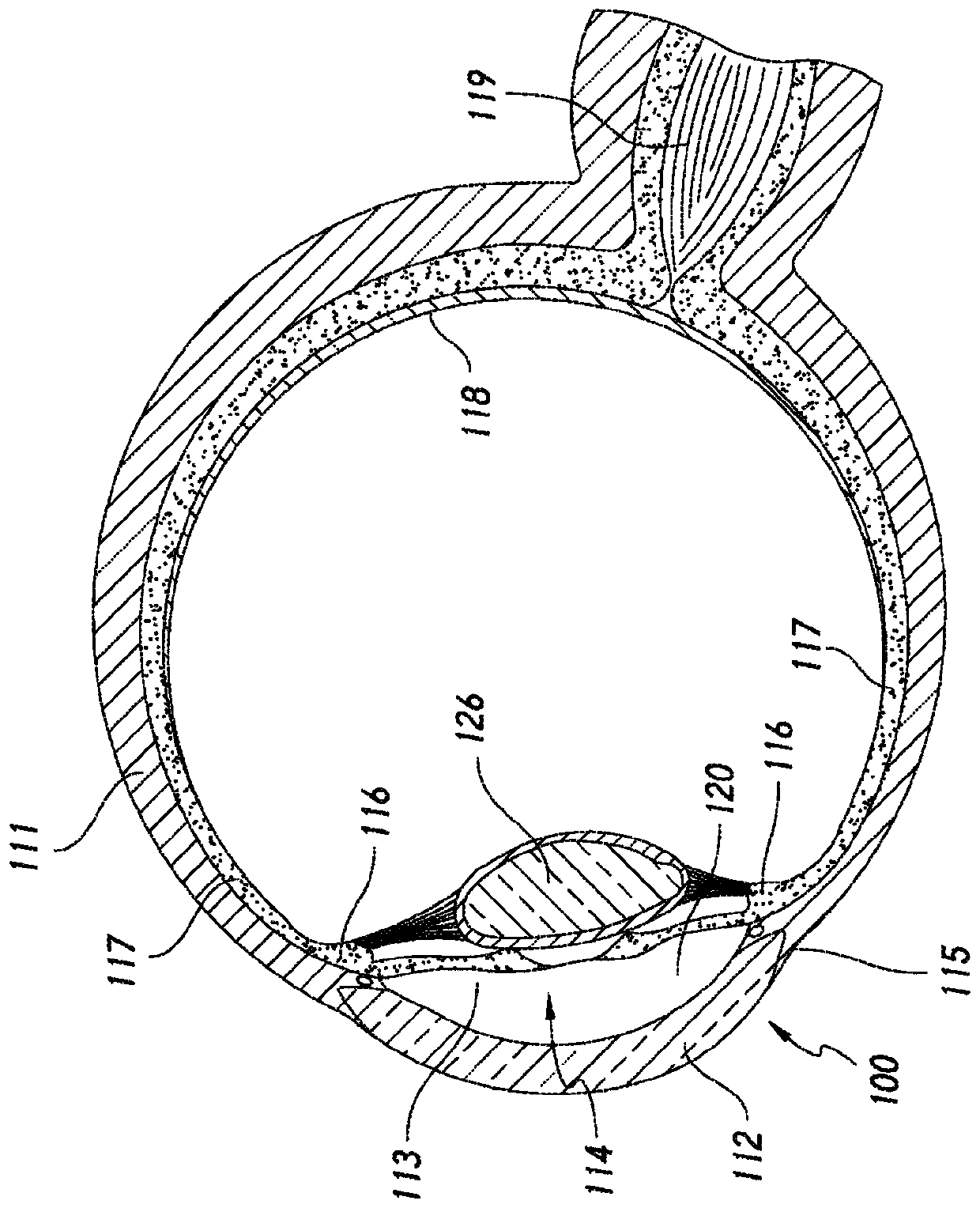 Systems and methods for delivering multiple ocular implants