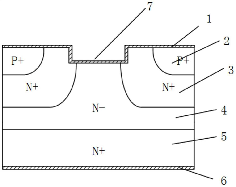 SiC MPS diode device and preparation method thereof