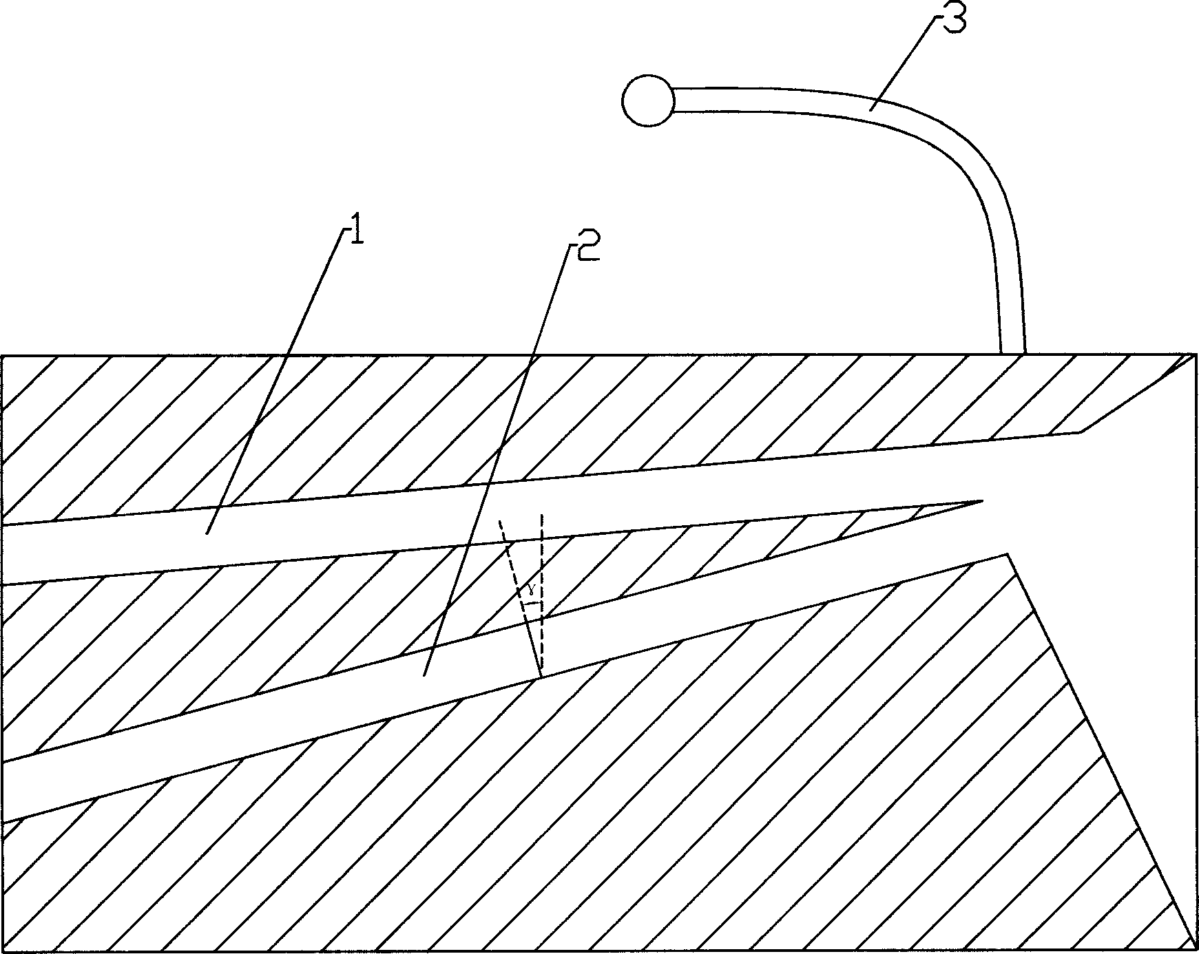 Anchorage preparation buccal tube