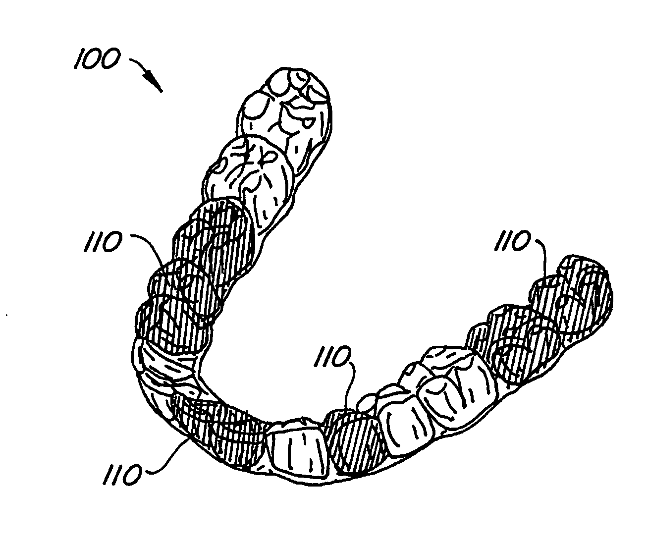 Systems and methods for varying elastic modulus appliances