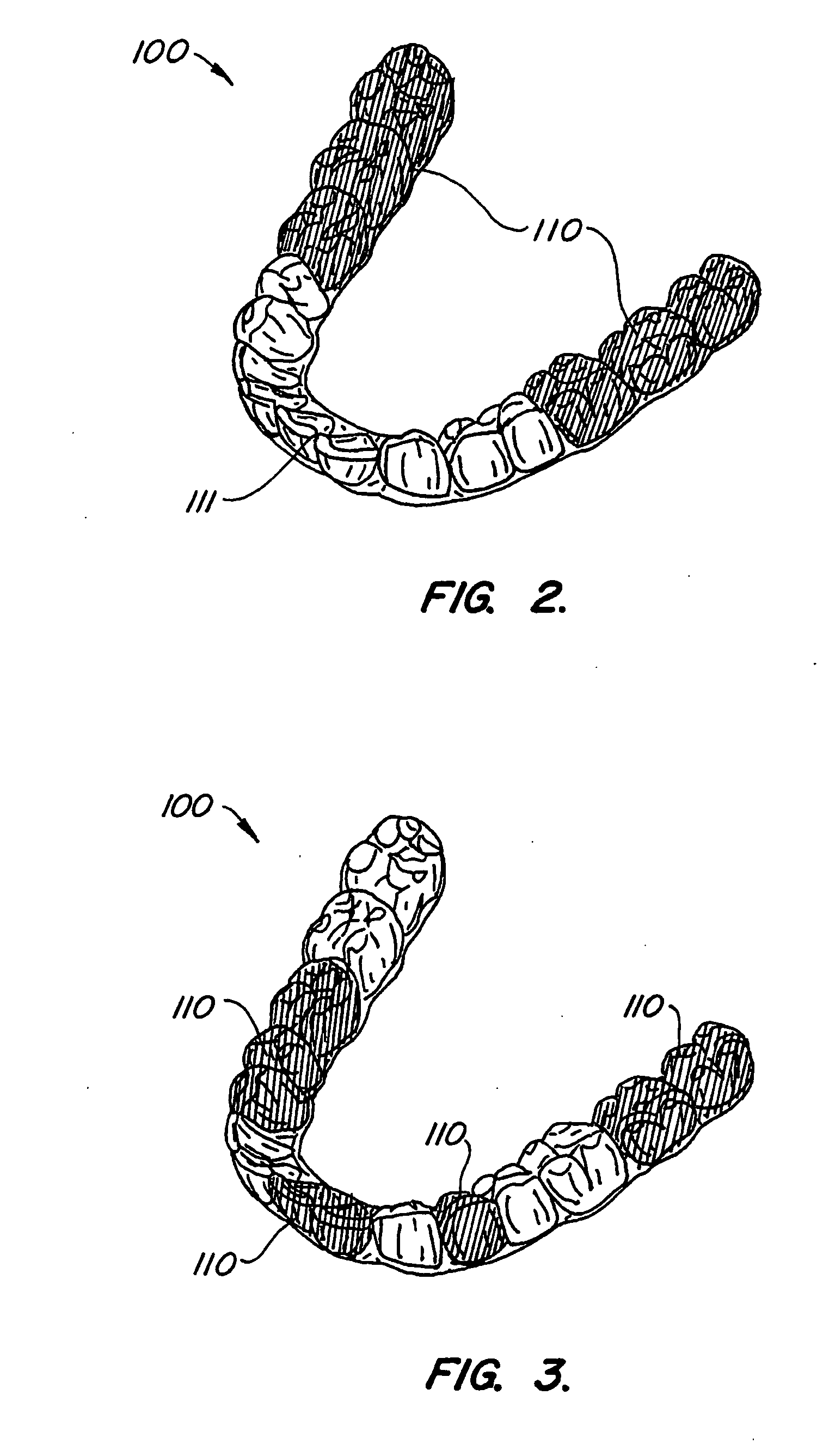 Systems and methods for varying elastic modulus appliances