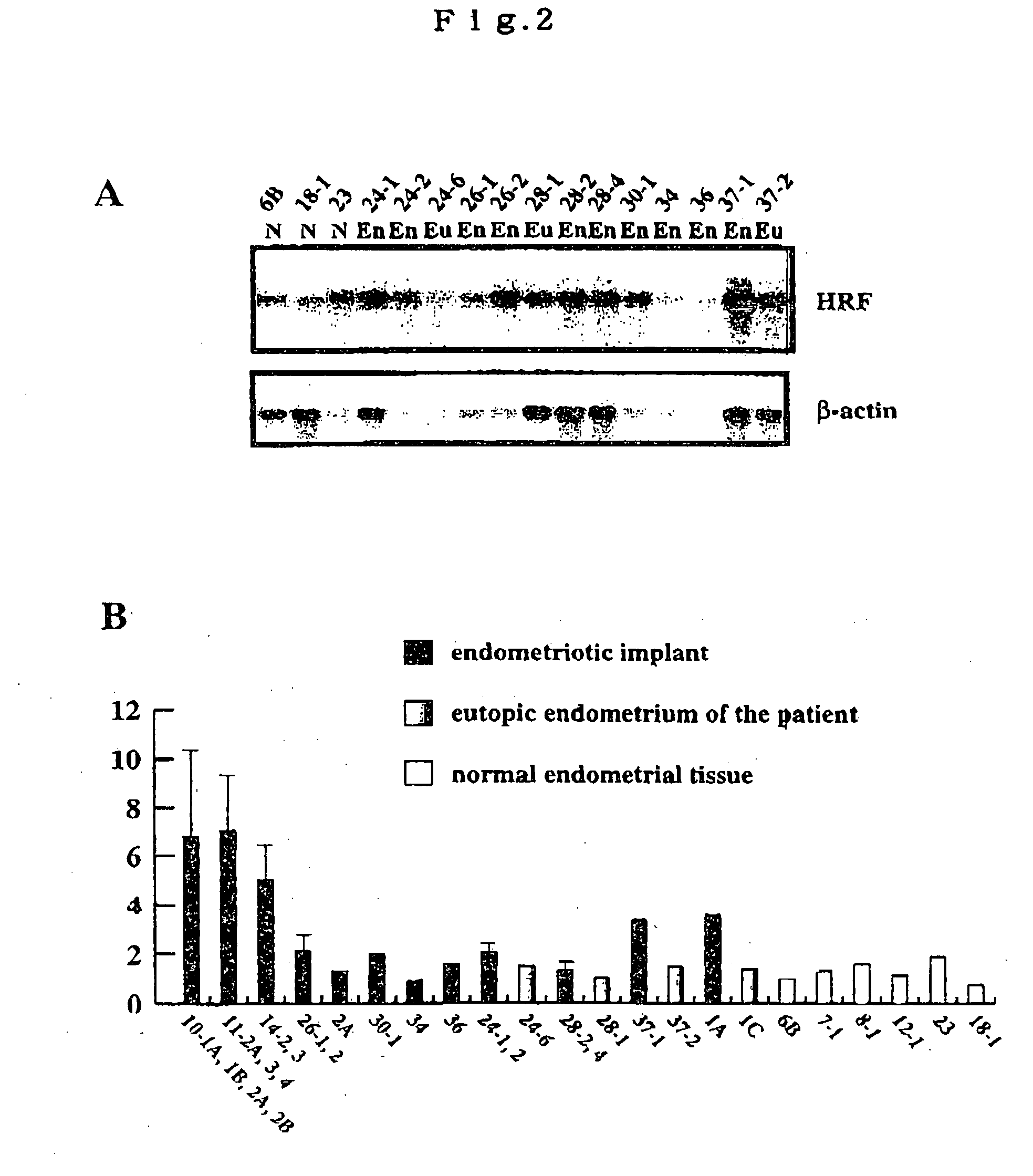 Method of diagnosing disease relating to endometriosis