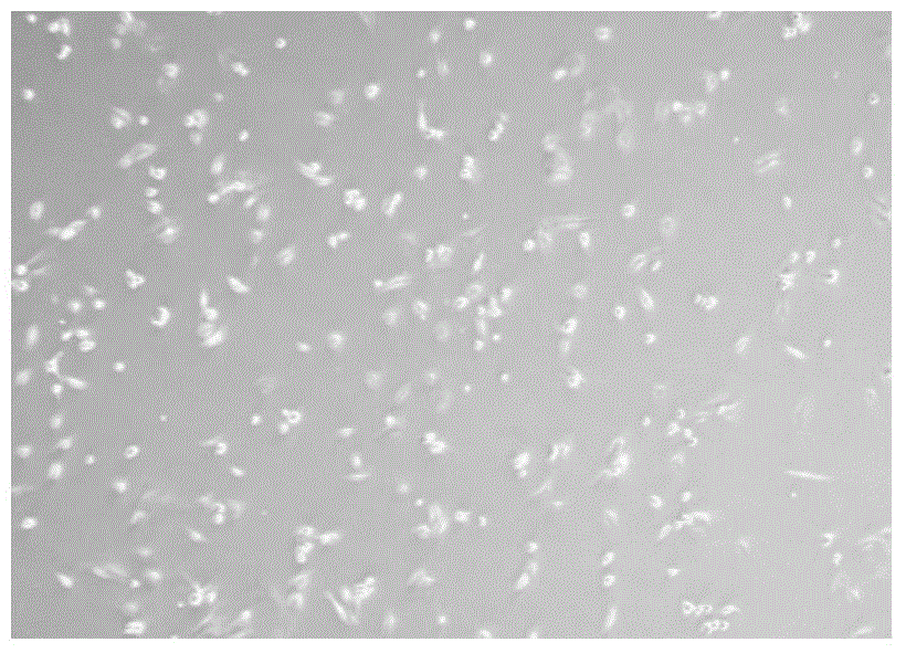 Primary isolated culture method for amniotic fluid mesenchymal stem cells