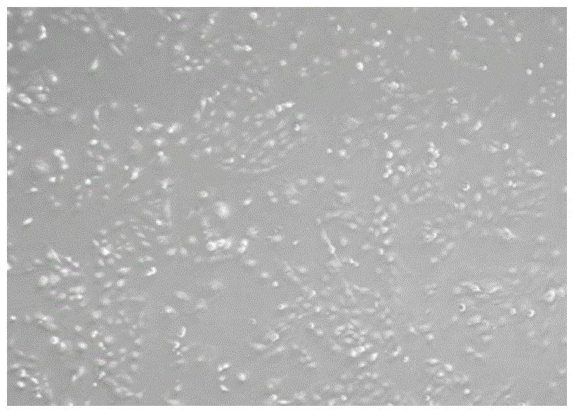 Primary isolated culture method for amniotic fluid mesenchymal stem cells