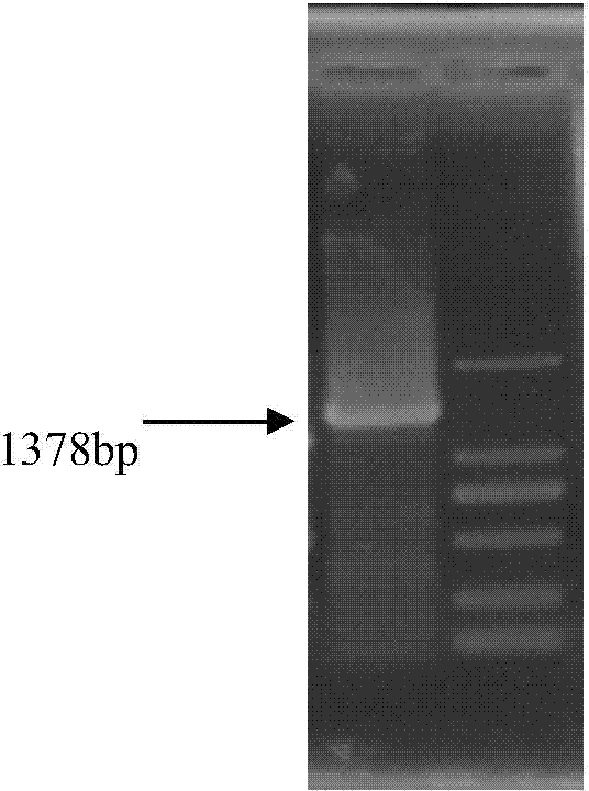 Specific expression and activity analysis of ace2 promoter in central nervous system of cotton aphid