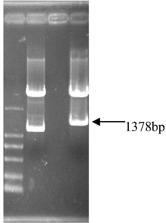 Specific expression and activity analysis of ace2 promoter in central nervous system of cotton aphid